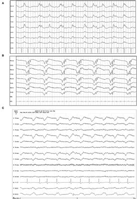 Periodic discharges in veterinary electroencephalography—A visual review